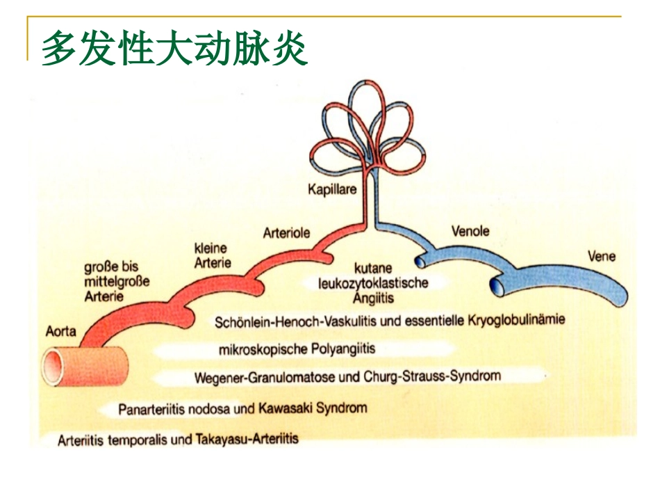 多发性大动脉炎1_第3页