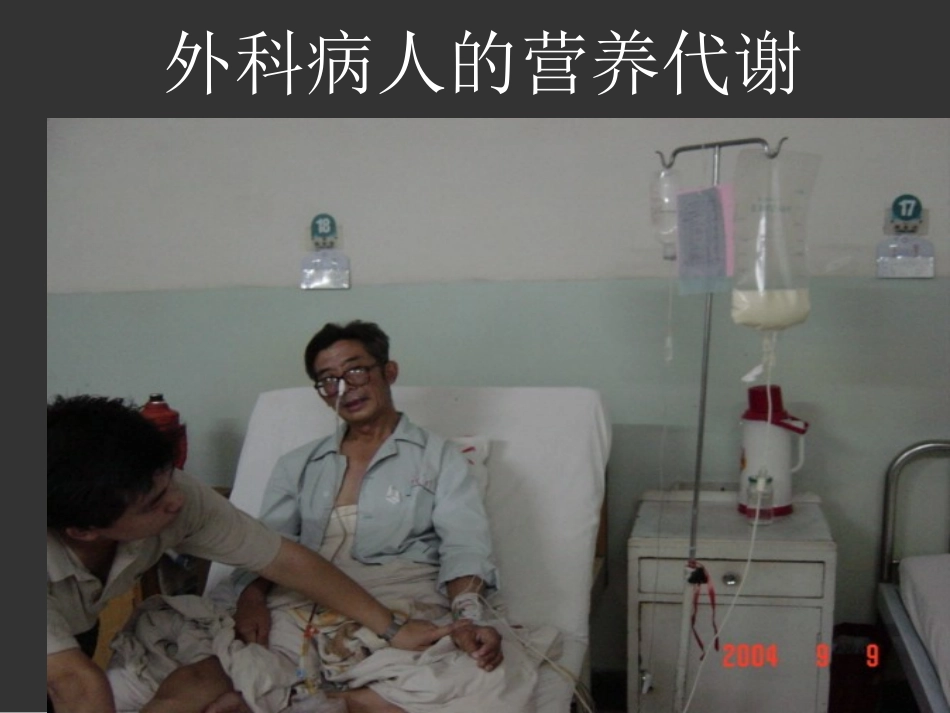 外科病人的营养代谢(精)_第1页