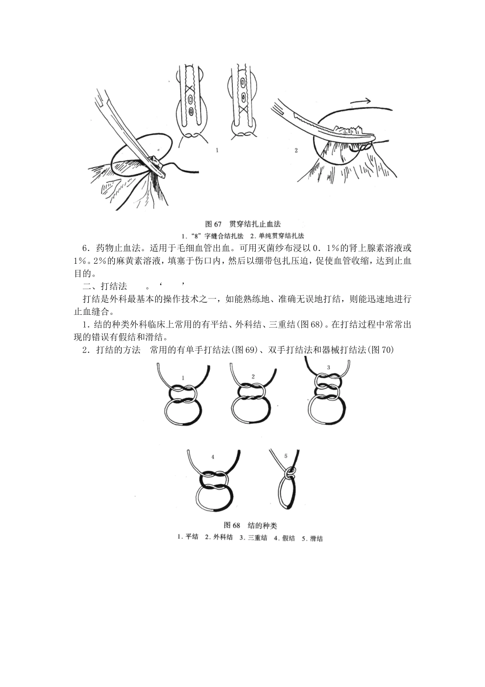 外科手术(止血、缝合、打结及绷带技术(图))_第2页