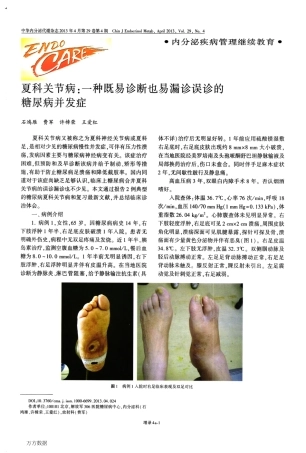 夏科关节病_一种既易诊断也易漏诊误诊的糖尿病并发症
