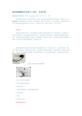 复脑动脉瘤概述及血管介入治疗