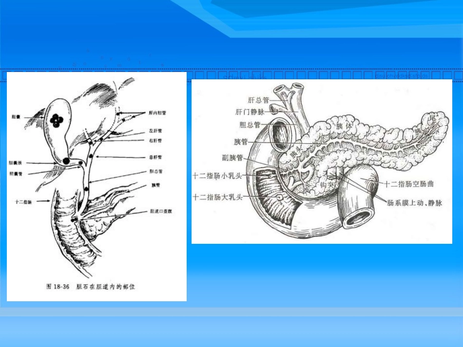 壶腹部占位检查方法_第3页