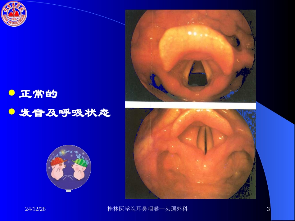 喉阻塞与急救_第3页