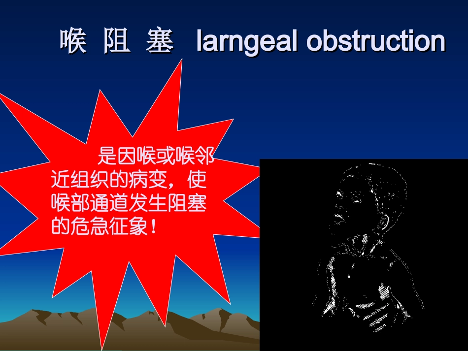 喉梗阻及气管切开_第3页
