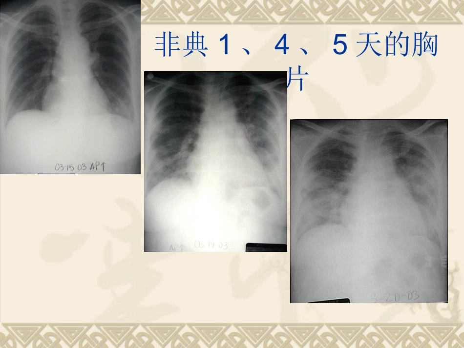 呼吸机的急诊应用_第2页