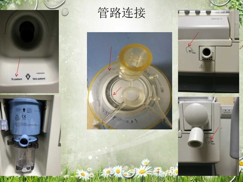 呼吸机模式及参数简介_第3页