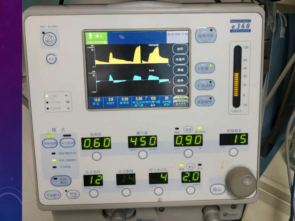 呼吸机常用模式_第2页