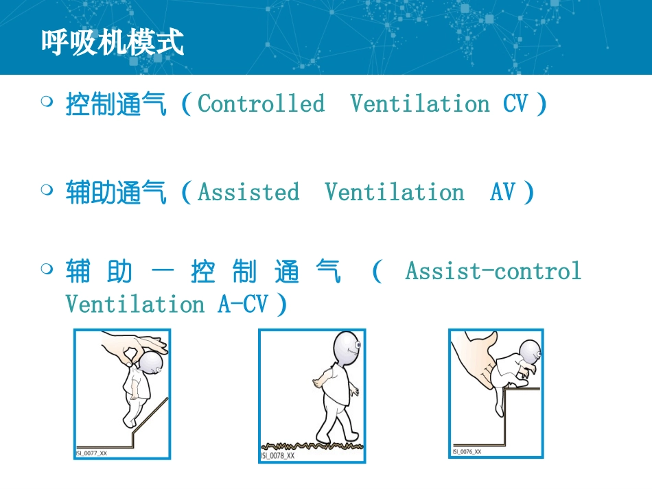 呼吸机常用参数及设置_第3页