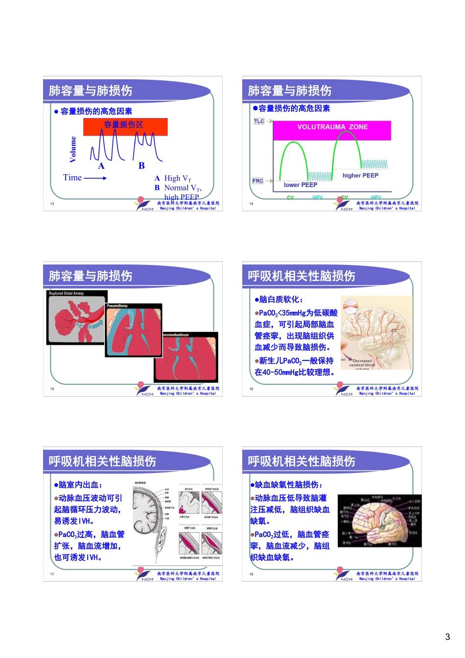 周晓光-容量保证通气_第3页