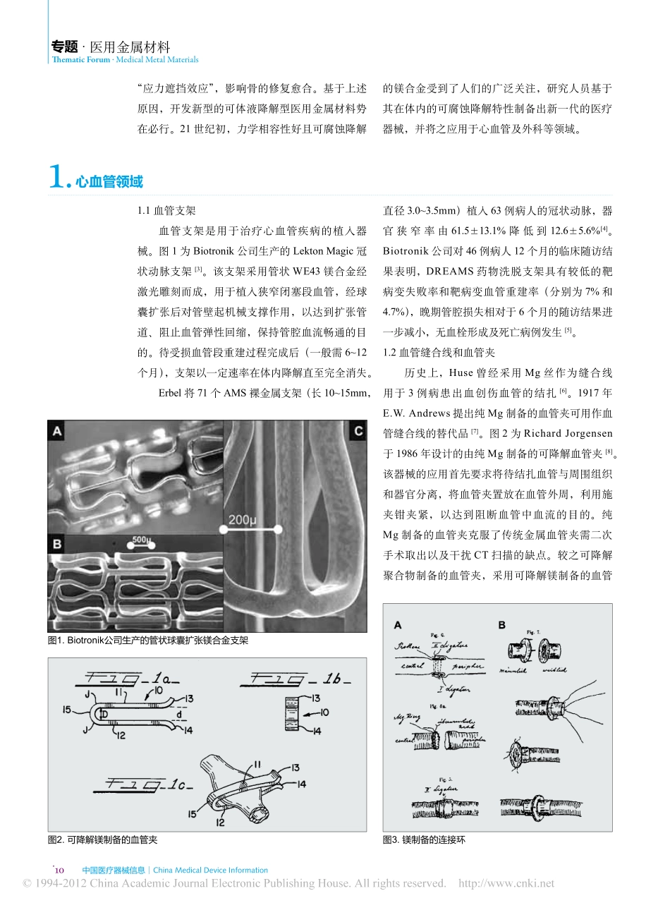可降解镁合金医疗器械的研发现状_第2页