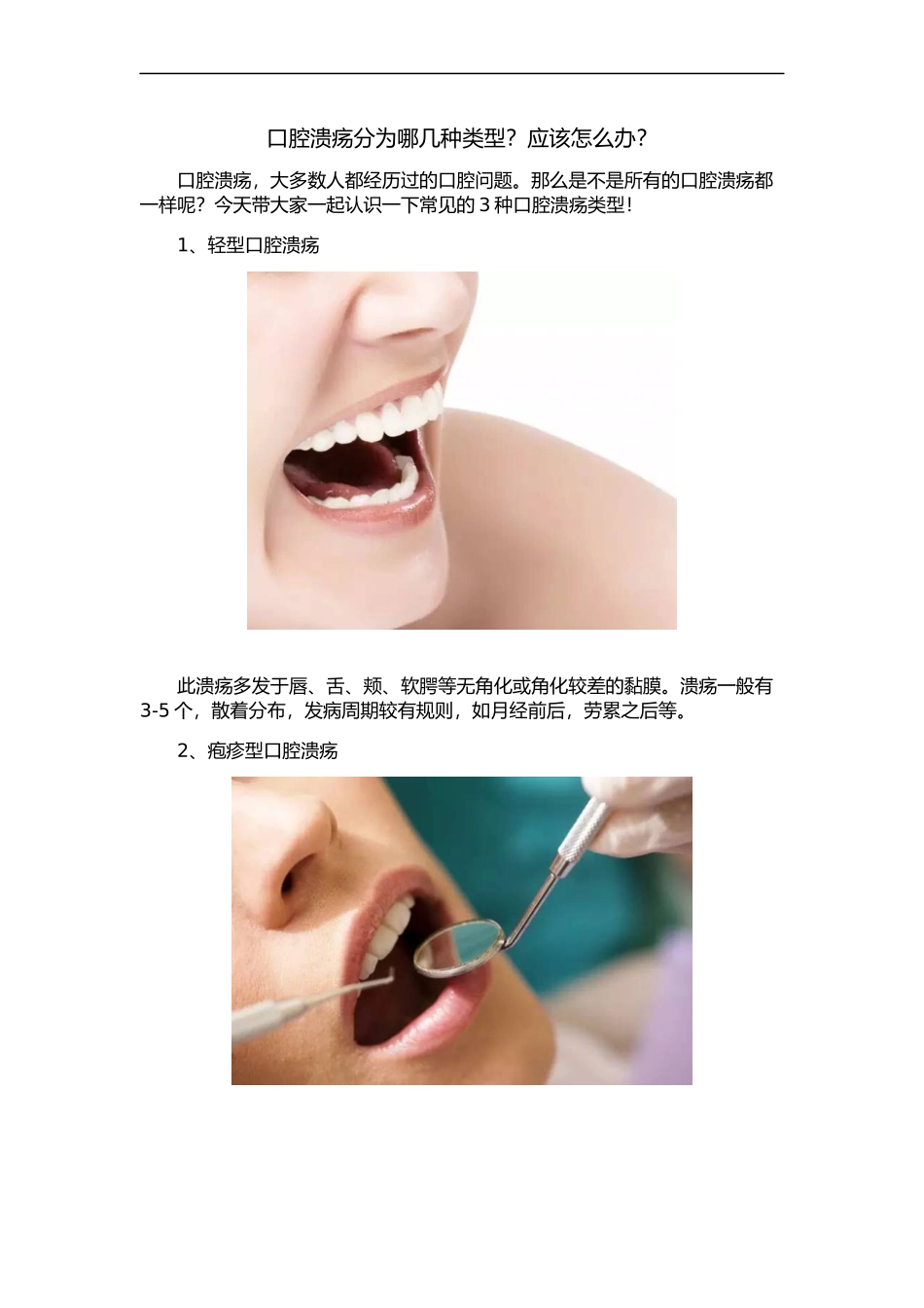口腔溃疡分为哪几种类型？应该怎么办？_第1页