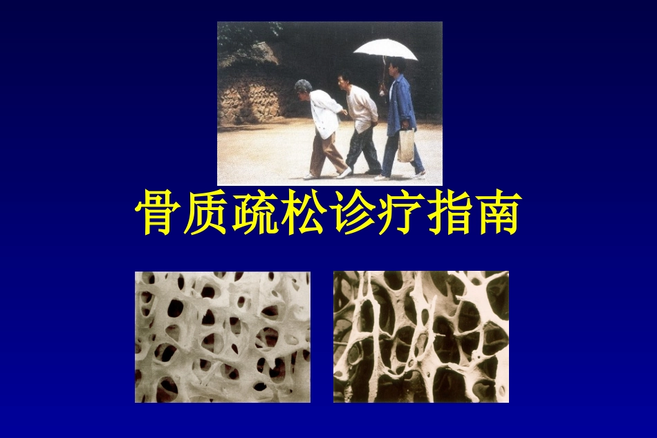 原发性骨质疏松症诊治指南_第1页