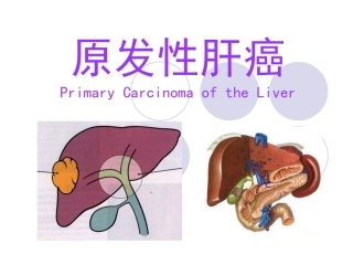 原发性肝癌-俞