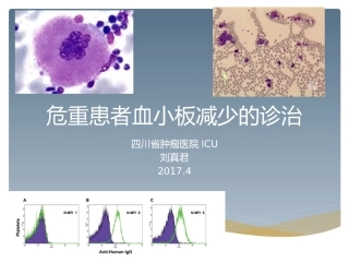 危重患者血小板减少的诊治