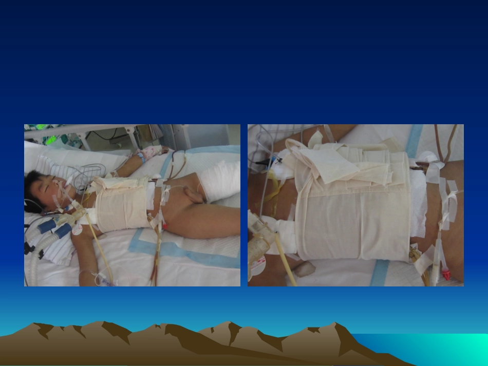 危重患儿营养支持_第2页