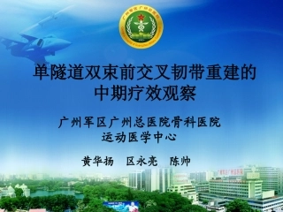 单隧道双束前交叉韧带重建的中期疗效观察