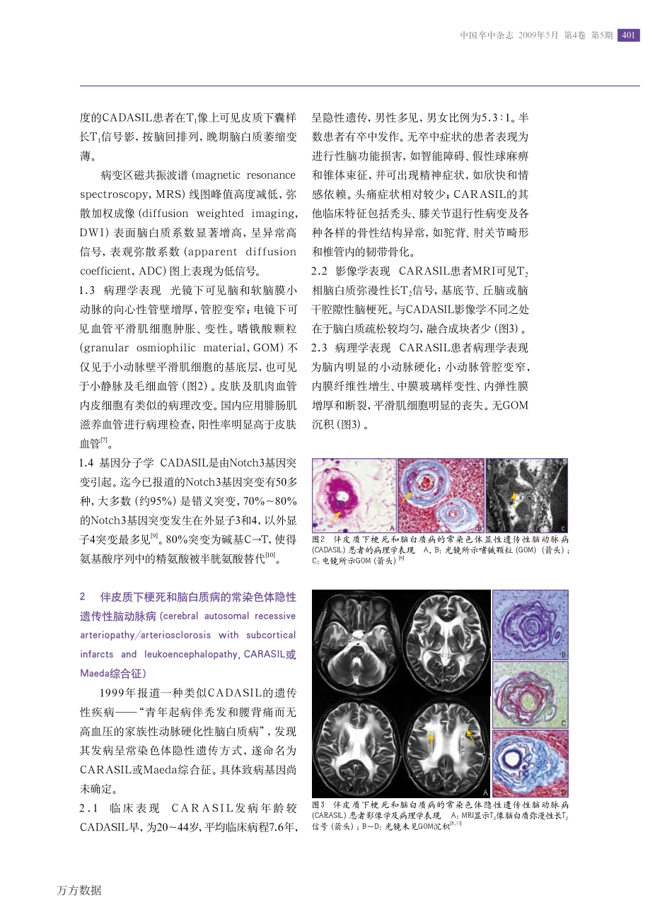 单基因遗传性脑小血管病_第2页