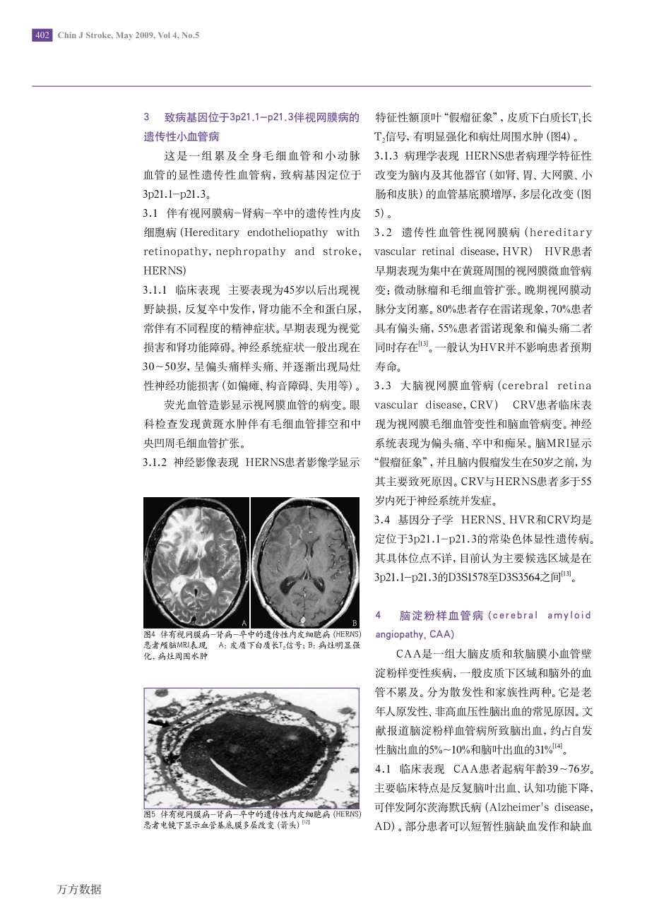 单基因遗传性脑小血管病_第3页