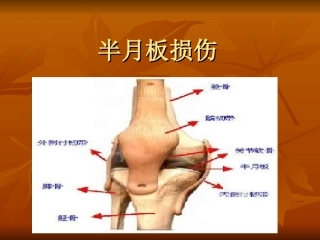 半月板损伤影像表现