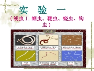 医本一蛔虫钩虫鞭虫蛲虫