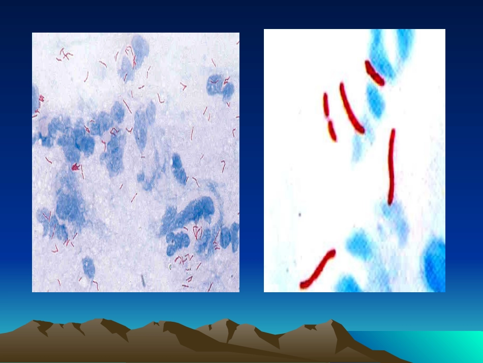 北京耐多药肺结核控制项目试验室相关问题_第3页