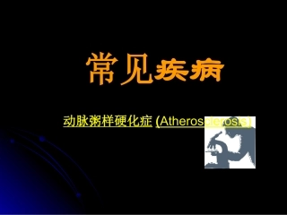 动脉粥样硬化症