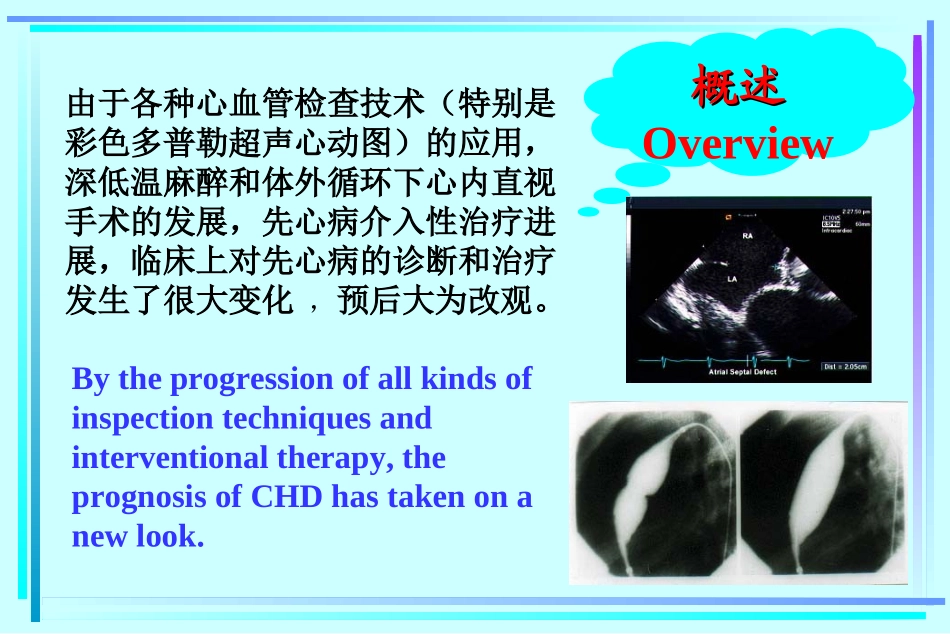 动脉导管未闭_第3页