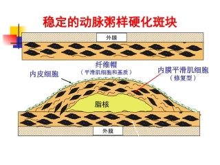 动脉硬化心脏病
