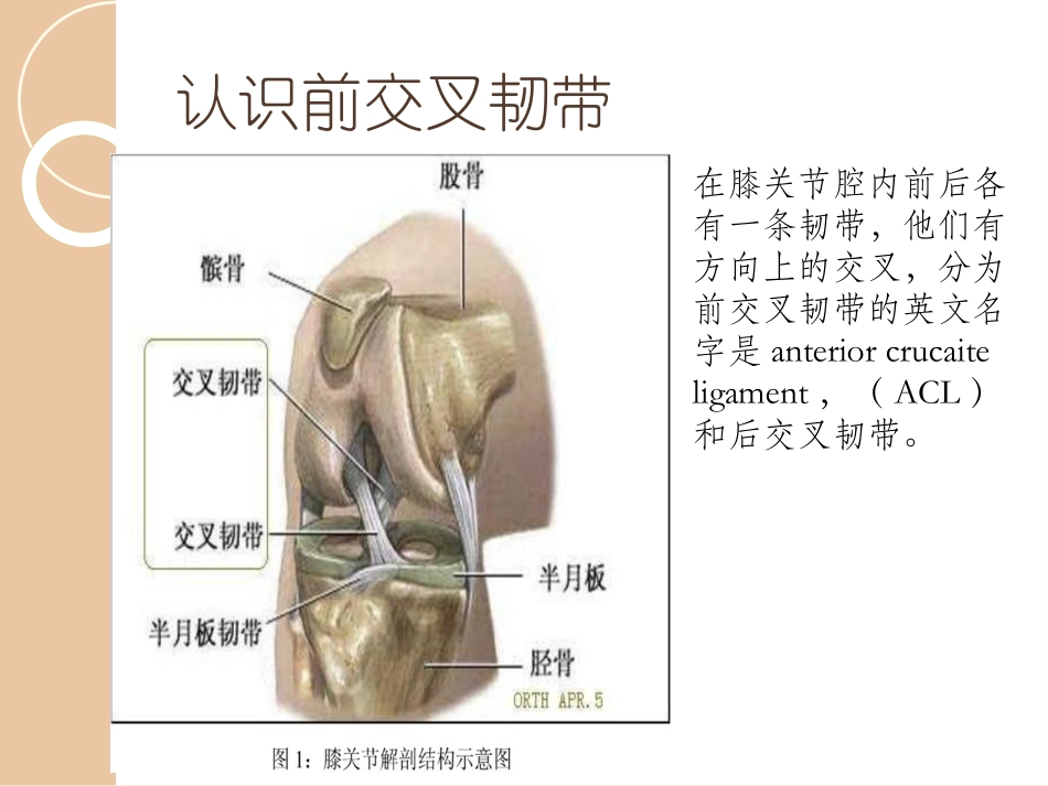 前叉韧带损伤的教学查房_第3页