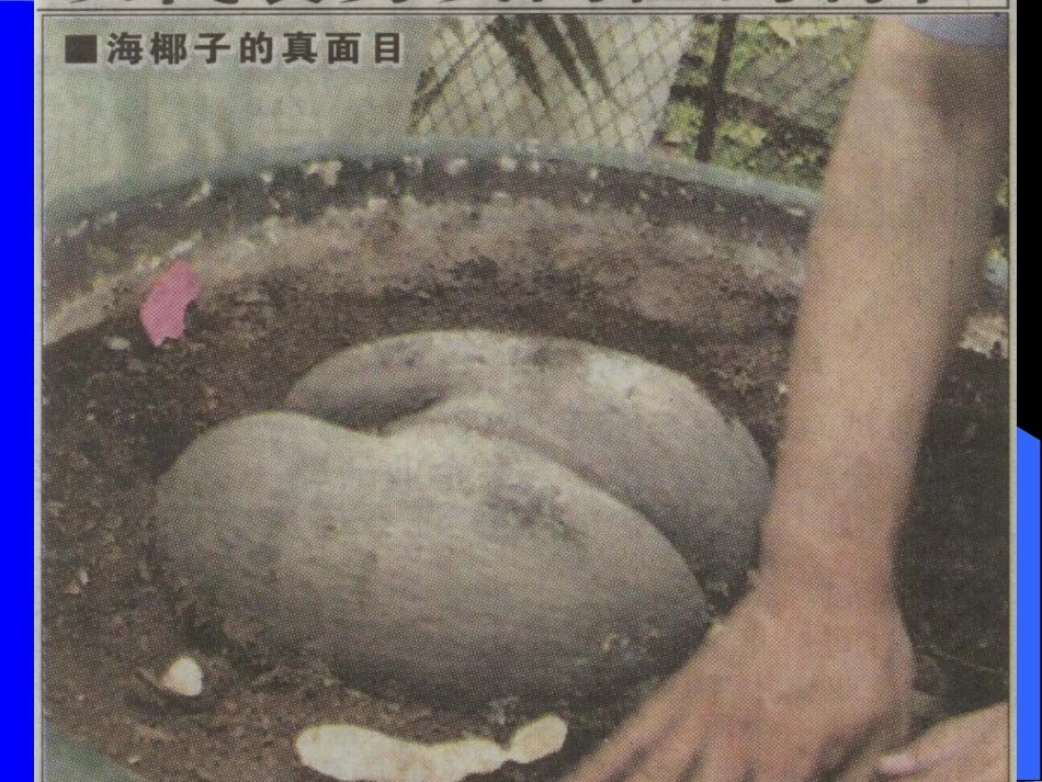 前列腺癌-刘新帆_第2页