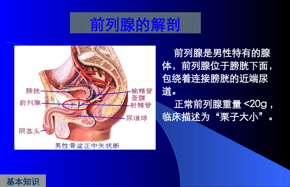 前列腺炎症及增生症_第3页