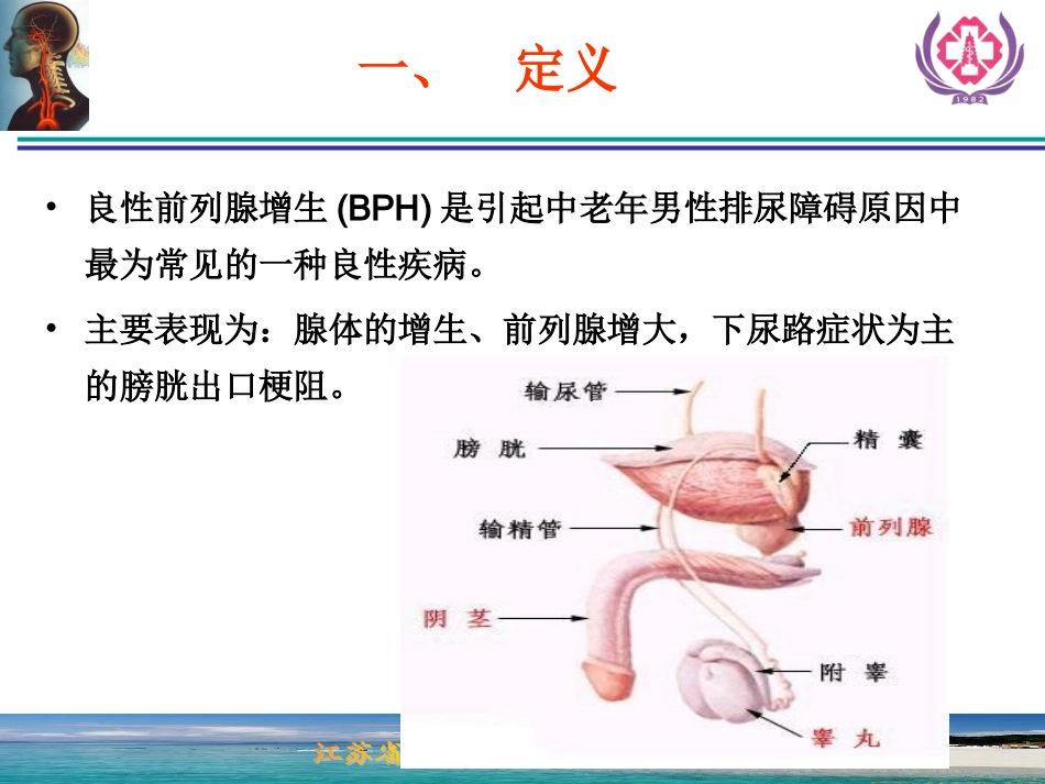 前列腺增生症的诊断治疗_第2页