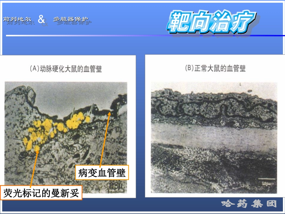 前列地尔-脏器保护ICU_第3页