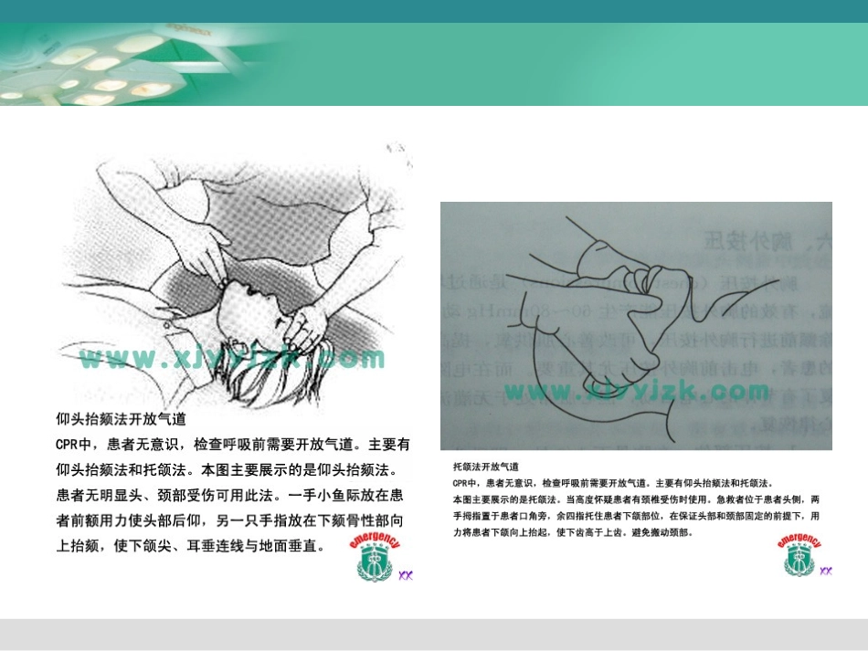 创伤的早期救治_第3页