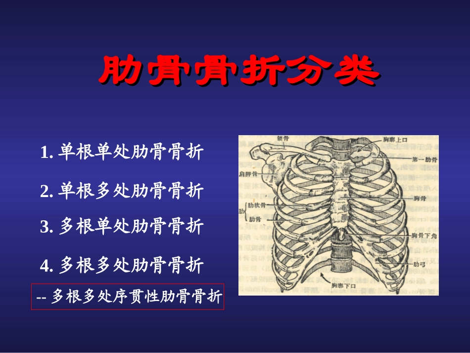 创伤性连枷胸合并ARDS_第3页