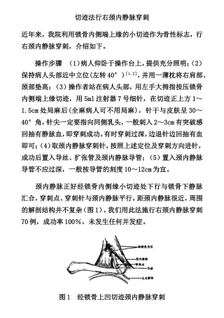 切迹法行右颈内静脉穿刺