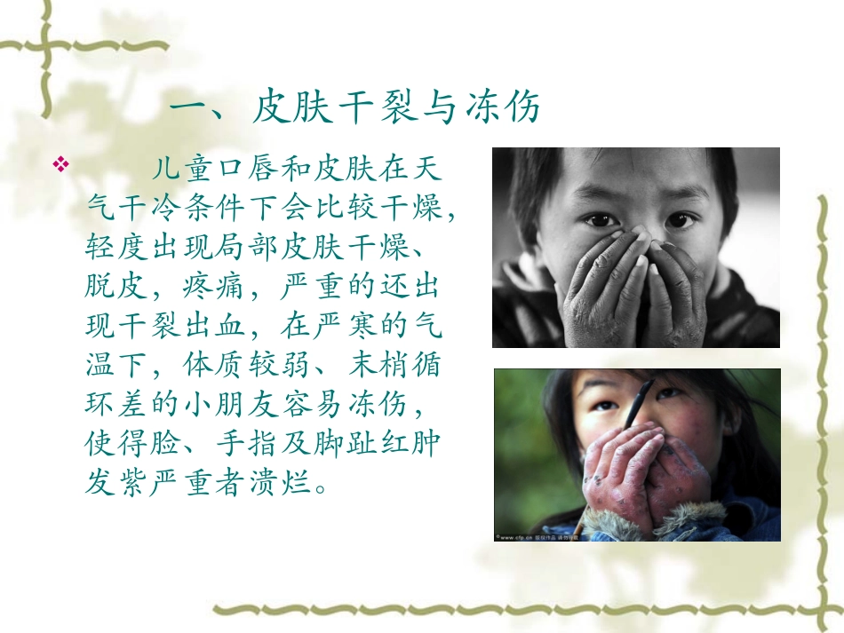 冬季及学龄儿童常见病_第2页