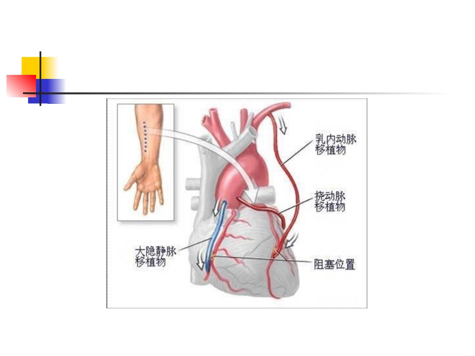 冠脉搭桥术健康宣教_第3页