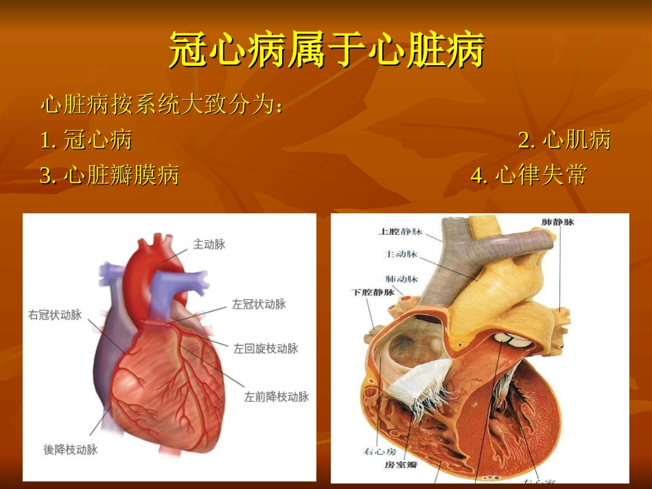 冠心病与猝死幻灯汇总_第2页