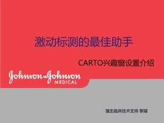 兴趣窗的设定 激动标测介绍