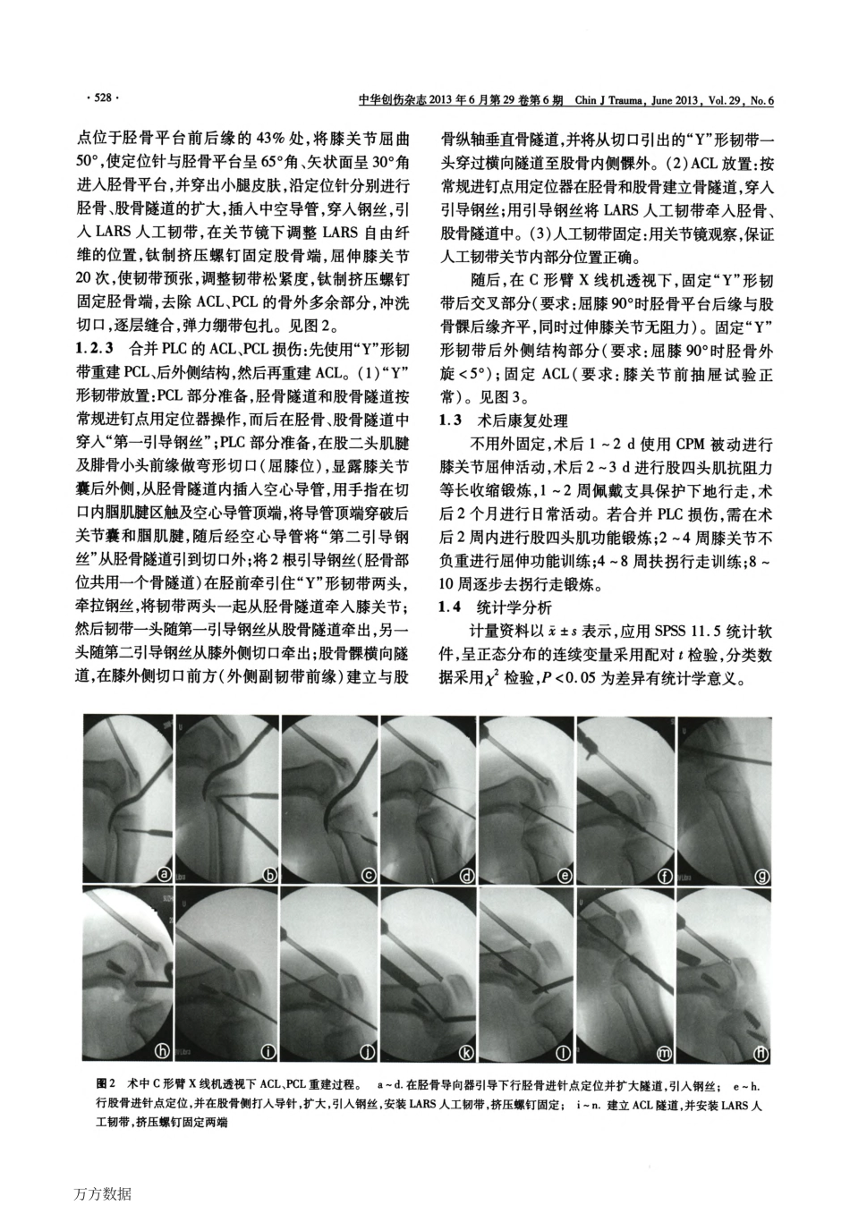 关节镜下使用LARS人工韧带重建膝前、后交叉韧带_第3页