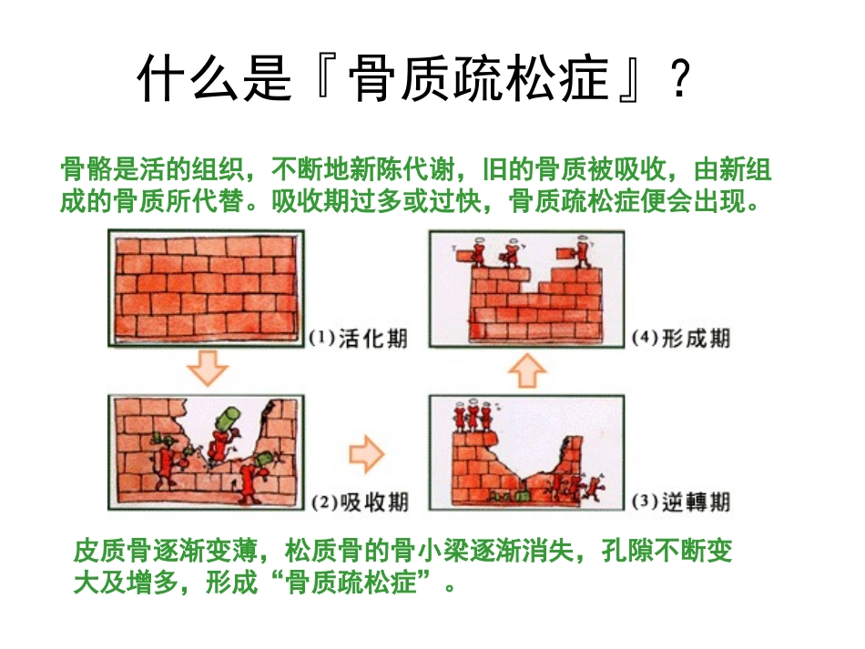 关节痛之骨质疏松_第3页