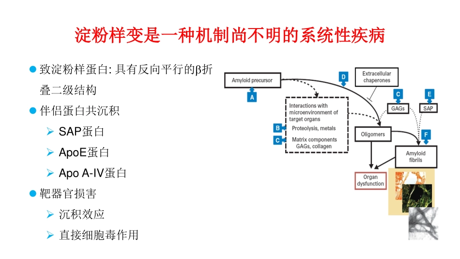 六。淀粉样变的诊断和分型进展李剑_第2页