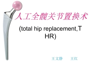 全髋关节置换