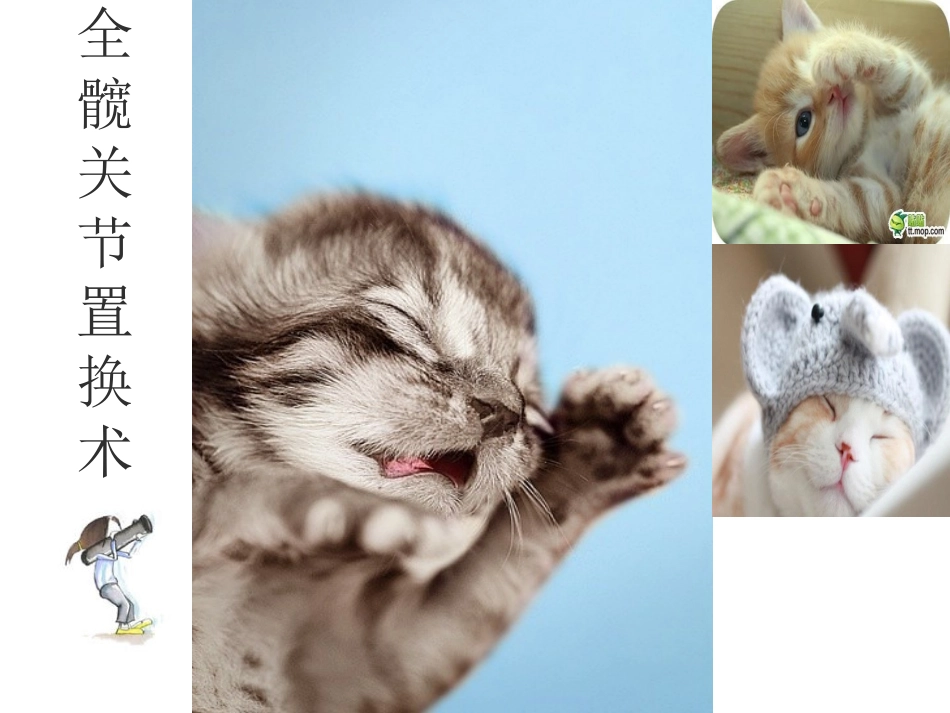 全款关节置换术后功能锻炼_第1页