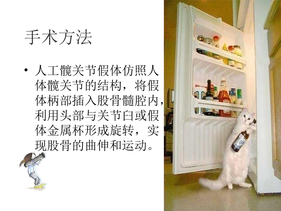 全款关节置换术后功能锻炼_第3页