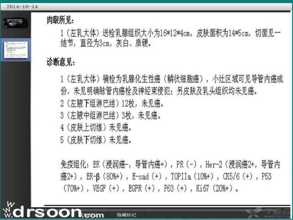 儿科急诊腹部超声_第2页