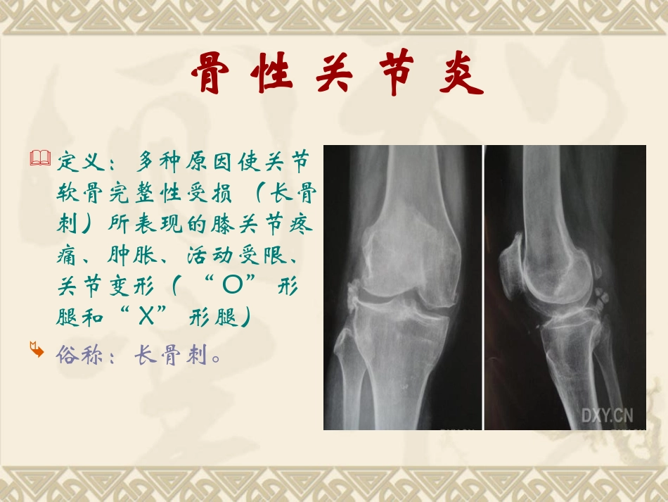 健康知识讲座膝关节_第2页