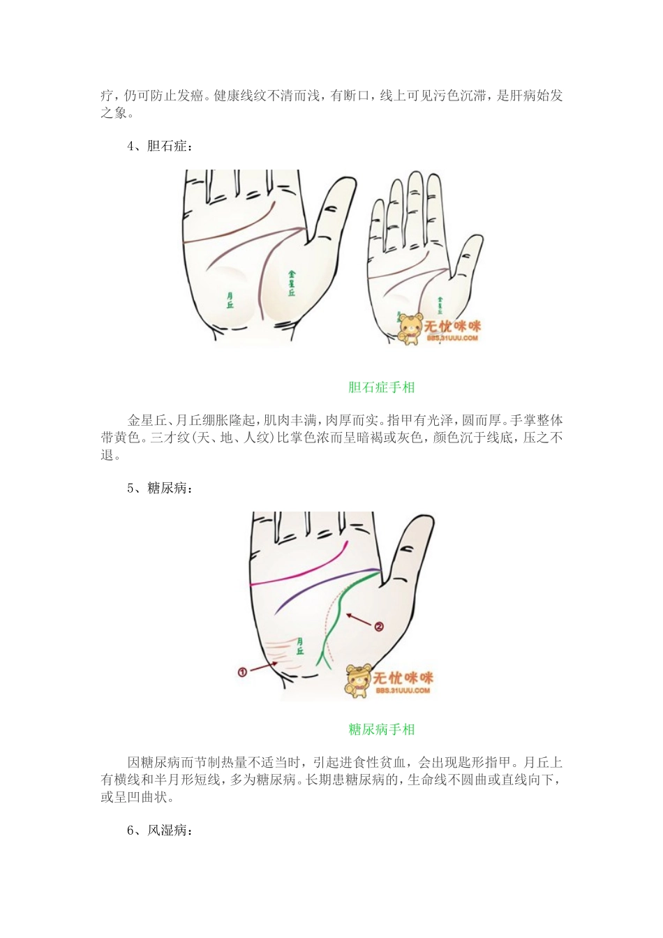做自己的医生24种手相揭示身心健康问题_第3页