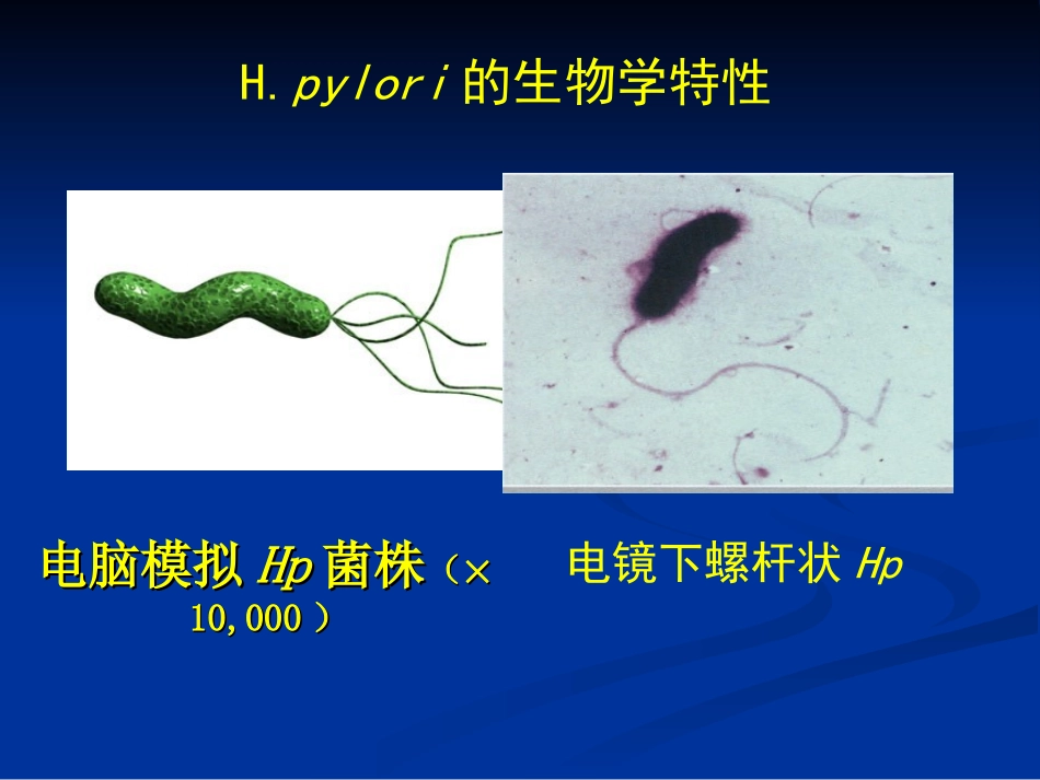 依赖于胃镜活检快速尿素酶试验RUT_第2页